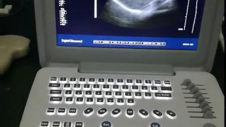 Scanner per ultrasuoni portatile digitale in bianco e nero per ospedale per ginecologia