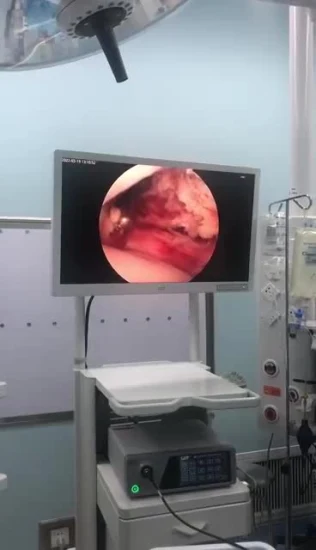 Endoscopio laparoscopico Attrezzatura medica Strumento laparoscopico