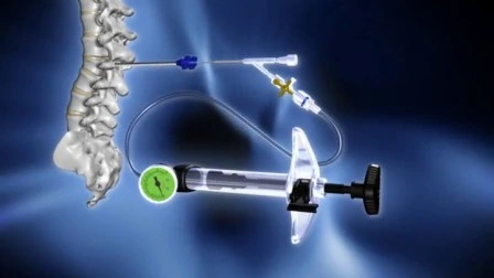 Strumenti per chirurgia mini-invasiva della colonna vertebrale ortopedica medica Dragon Crown